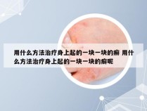 用什么方法治疗身上起的一块一块的癣 用什么方法治疗身上起的一块一块的癣呢