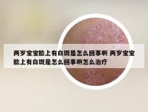 两岁宝宝脸上有白斑是怎么回事啊 两岁宝宝脸上有白斑是怎么回事啊怎么治疗