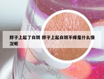 脖子上起了白斑 脖子上起白斑不痒是什么情况呢