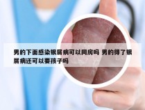 男的下面感染银屑病可以同房吗 男的得了银屑病还可以要孩子吗