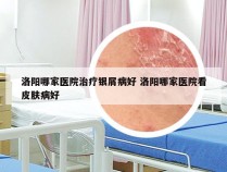 洛阳哪家医院治疗银屑病好 洛阳哪家医院看皮肤病好