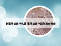 副银屑病光疗机器 银屑病光疗副作用有哪些