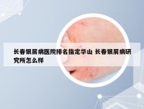 长春银屑病医院排名指定华山 长春银屑病研究所怎么样