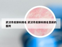 武汉市皮肤科排名 武汉市皮肤科排名靠前的医院