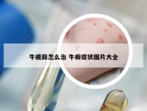 牛疲藓怎么治 牛癣症状图片大全