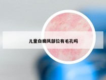 儿童白癜风部位有毛孔吗