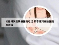 长春博润皮肤病医院电话 长春博润皮肤医院怎么样