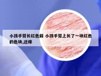 小孩手臂长红色藓 小孩手臂上长了一块红色的色块,还痒