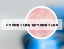 冶牛皮鲜有什么倘方 治疗牛皮鲜有什么新药