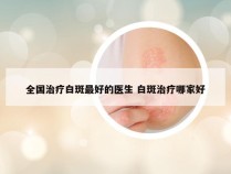 全国治疗白斑最好的医生 白斑治疗哪家好