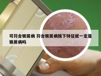 可符合银屑病 符合银屑病镜下特征就一定是银屑病吗