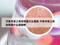 只有手背上有白斑是什么原因 只有手背上有白斑是什么原因呢