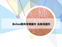 白dian殿风早期图片 白殿凤图片