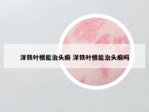 洋铁叶根能治头癣 洋铁叶根能治头癣吗