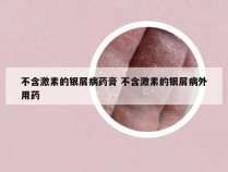 不含激素的银屑病药膏 不含激素的银屑病外用药