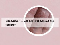 皮肤白斑吃什么补黑色素 皮肤白斑吃点什么保健品好