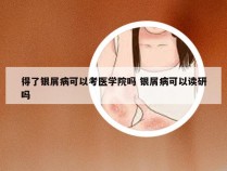 得了银屑病可以考医学院吗 银屑病可以读研吗