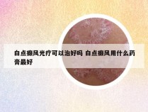 白点癫风光疗可以治好吗 白点癫风用什么药膏最好