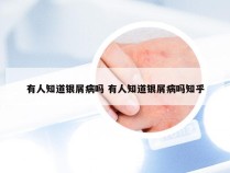 有人知道银屑病吗 有人知道银屑病吗知乎