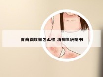 青癣霜效果怎么样 清癣王说明书