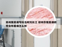 郑州银屑病专科当听刘长江 郑州市银屑病研究会所看病怎么样