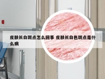 皮肤长白斑点怎么回事 皮肤长白色斑点是什么病