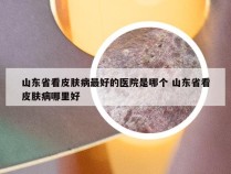 山东省看皮肤病最好的医院是哪个 山东省看皮肤病哪里好