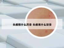 头癣擦什么药膏 头癣用什么软膏