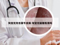 淘宝光效也算牛皮癣 淘宝光触媒有用吗