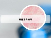 维医治白癜风