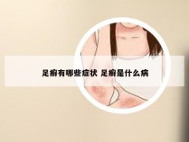 足癣有哪些症状 足癣是什么病