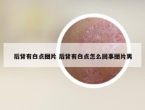 后背有白点图片 后背有白点怎么回事图片男