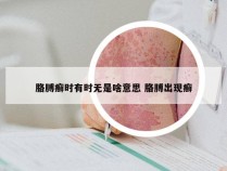 胳膊癣时有时无是啥意思 胳膊出现癣