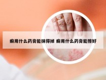 癣用什么药膏能抹得掉 癣用什么药膏能擦好