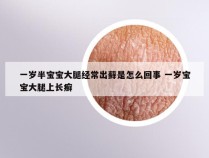 一岁半宝宝大腿经常出藓是怎么回事 一岁宝宝大腿上长癣