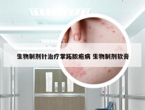 生物制剂针治疗掌跖脓疱病 生物制剂软膏