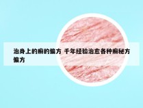 治身上的癣的偏方 千年经验治愈各种癣秘方偏方