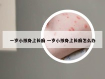 一岁小孩身上长癣 一岁小孩身上长癣怎么办