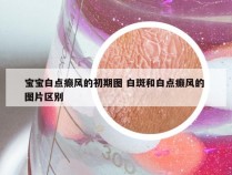 宝宝白点癫风的初期图 白斑和白点癫风的 图片区别