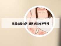 银屑病能吃笋 银屑病能吃笋干吗