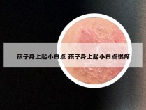 孩子身上起小白点 孩子身上起小白点很痒