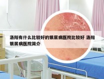 洛阳有什么比较好的银屑病医院比较好 洛阳银屑病医院简介