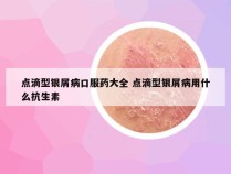 点滴型银屑病口服药大全 点滴型银屑病用什么抗生素