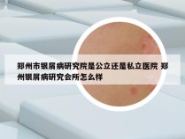 郑州市银屑病研究院是公立还是私立医院 郑州银屑病研究会所怎么样