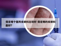 保定哪个医院皮肤科比较好 保定哪的皮肤科最好?