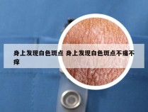 身上发现白色斑点 身上发现白色斑点不痛不痒