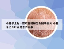 小肚子上起一些红色的癣怎么回事图片 小肚子上长红点是怎么回事