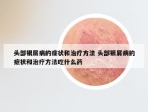 头部银屑病的症状和治疗方法 头部银屑病的症状和治疗方法吃什么药