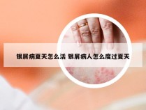 银屑病夏天怎么活 银屑病人怎么度过夏天