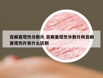 百癣夏塔热分散片 百癣夏塔热分散片和百癣夏塔热片有什么区别